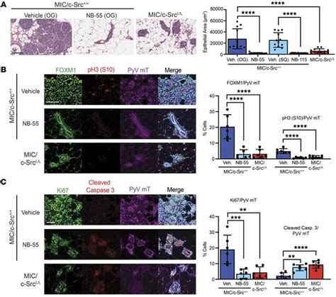 JCI Coordinated Activation Of C Src And FOXM1 Drives Tumor Cell