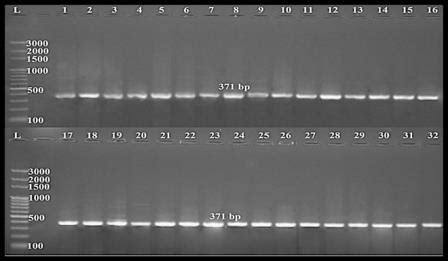 Ethidium Bromide Stained Agarose Gel Electrophoresis Of Monoplex Pcr