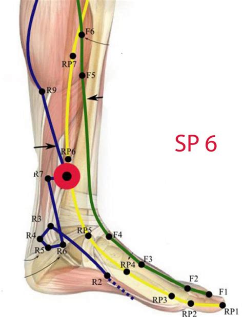 Acupuncture Point Injection Treatment Of Primary Dysmenorrhoea A Randomised Double Blind