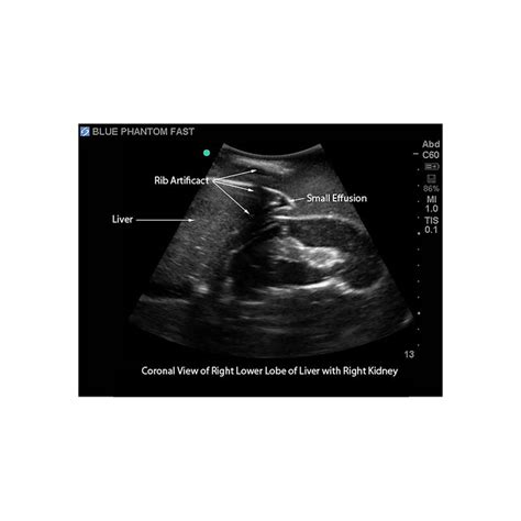 FAST Exam Ultrasound Training Model