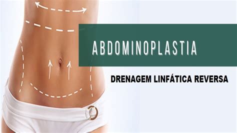 Drenagem Linfatica Reversa Em Abdominoplastia Youtube