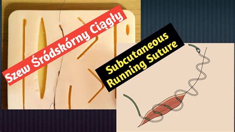 Szew śródskórny ciągły Subcuticular Running Suture Podstawowe