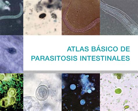 Atlas B Sico De Parasitosis Intestinales Lupa Ediciones