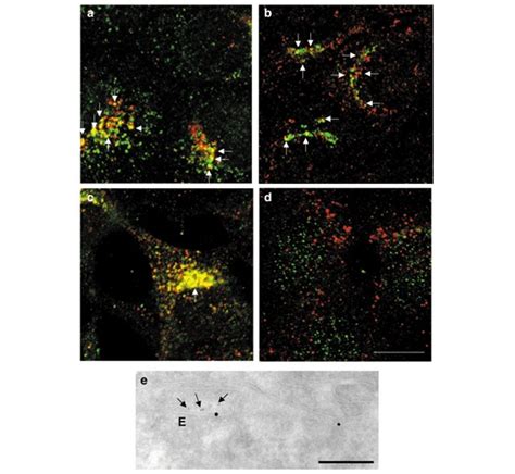 Partial Localization Of Ap 4 With Ap 1 Furin Mpr46 And Internalized