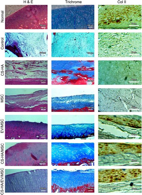 H E And Massons Trichrome Staining And Col Ii Immunostaining Of The