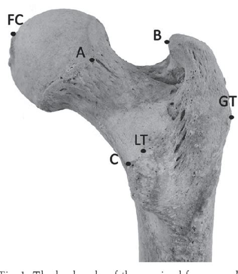 Figure 1 From Sex Estimation Using Measurements Of The Proximal Femur In A Historical Population