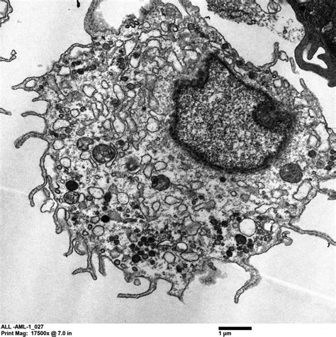 Magic cocktail generates lung’s most critical immune cell