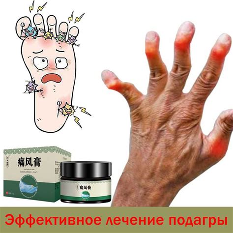 Крем от подагры 35 гм, быстрое облегчение боли в пальцах/ногах/коленях ...