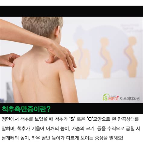 성장기 청소년 척추측만증 예방법