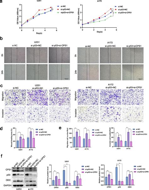 P53 Inhibits Glioma Progression By Targeting The Urea Cycle And