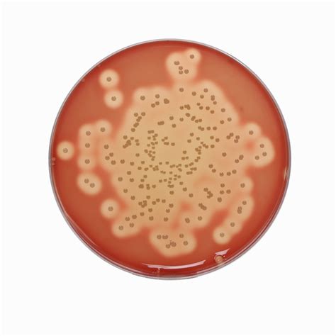 Blood Agar Base No W Agar Granulated Himedia Gm A