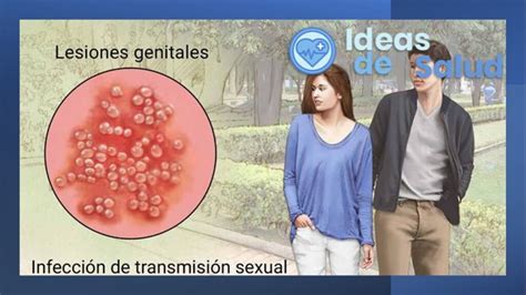 Que Es El Herpes Genital Sintomas Causas Y Como Tratar La Enfermedad Images