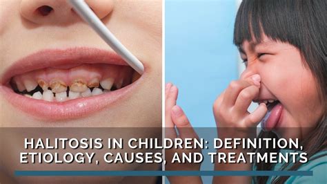 halitosis  children definition etiology   treatments