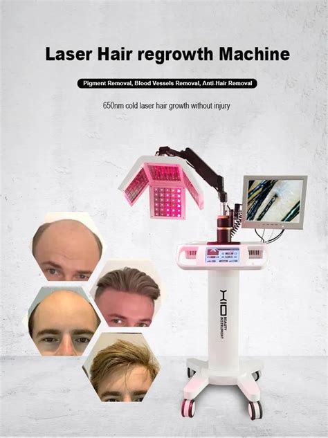 Advanced Femtosecond Laser Hair Therapy Apparatus For Hair Loss