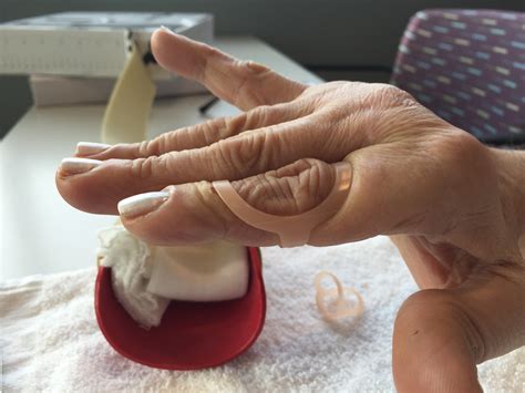 Certified Hand Therapist – Helping Hands Therapy 