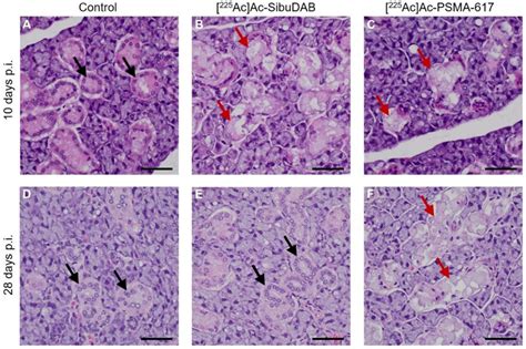 Cancers Free Full Text Ac Ac Sibudab For Targeted Alpha Therapy