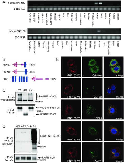 Characterization Of The Novel Ubiquitin Ligase Rnf A Expression