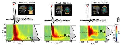 Nexstim TMS EEG