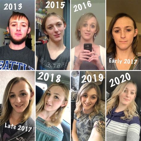 MTF Estrogen Timeline