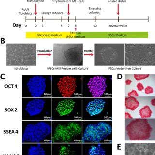 Characterization Of Acellular Nerve Grafts With Optimized Chemical