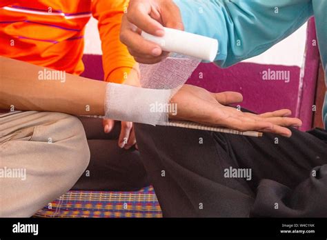 Broken Arm First Aid Hi Res Stock Photography And Images Alamy