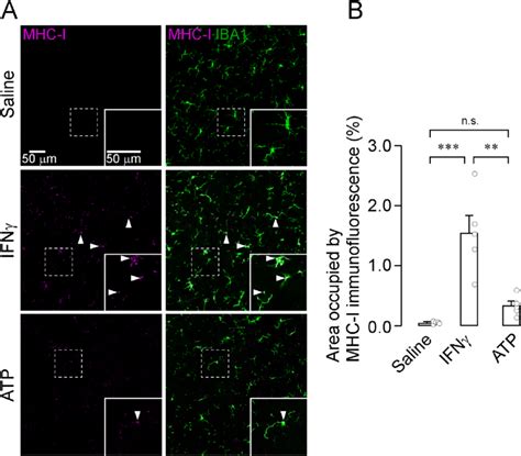 Induction Of Mhc I In Vc Microglia After Intracisternal Administration