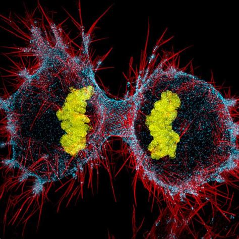 Human Hela Cell Undergoing Cell Division Photo Credit Dr Dylan