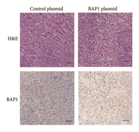 The Effect Of Mir And Bap On The Tumorigenicity In Nude Mice