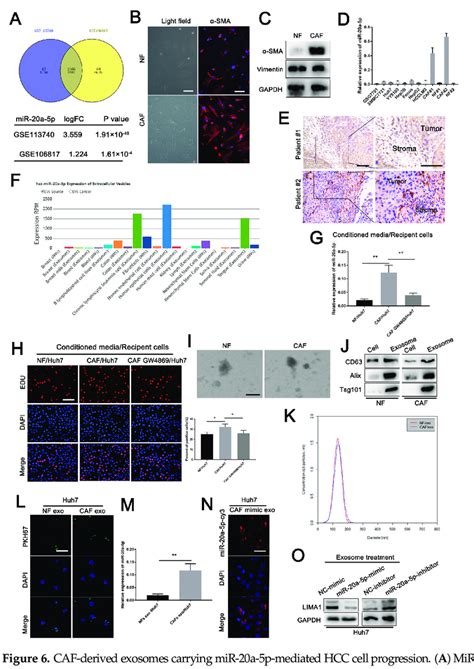 CAF Derived Exosomes Carrying MiR 20a 5p Mediated HCC Cell Progression