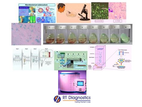 Culture Afb By Bactec Rt Diagnostics