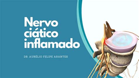 Nervo Ciático Inflamado Saiba Identificar E Como Tratar