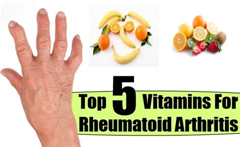 Top Vitamins For Rheumatoid Arthritis How To Treat Rheumatoid