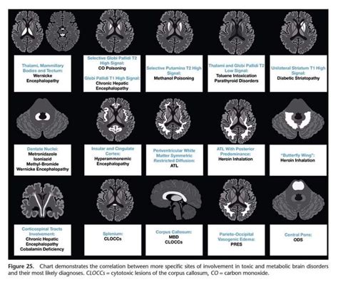 Pin By Jenny Duscio On Upgrading To MRI Medical Radiography