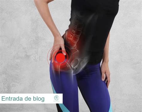 Dolor De Cadera El S Ndrome De Pinzamiento Femoroacetabular Rp