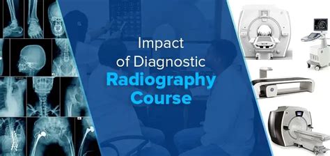 Impact of Diagnostic Radiography Course: Empowering Healthcare Industry