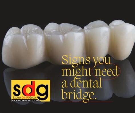 5 Signs You Might Need A Dental Bridge Sachem Dental Group