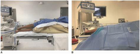 Internal Fixation Of Jones Fractures Musculoskeletal Key