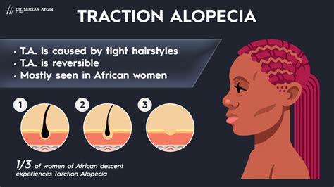 Traction Alopecia: Definition, Symptoms, and Prevention Strategies - Dr ...