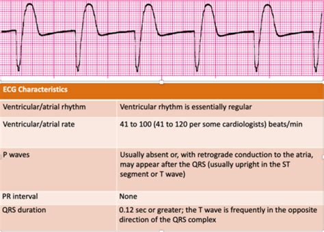 Agonal Rhythm