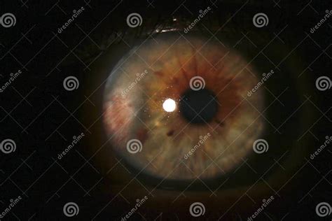 Human Eye With Cataract Investigation And Test Of The Eye Fundus Of