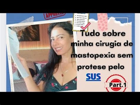 Tudo sobre minha cirurgia de mastopexia sem prótese pelo SUS Fui