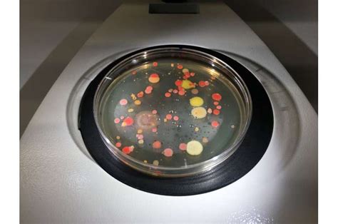 New bacterial culture methods could result in the discovery of new species