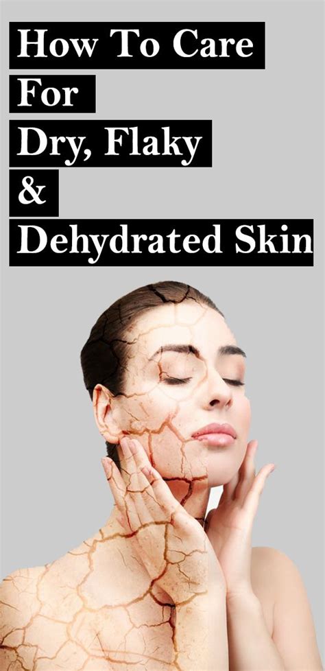 Best home remedies to get rid of dry skin cure dry skin – Artofit