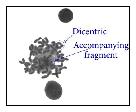 Photomicrographs Of Metaphase Bone Marrow Cells Week After