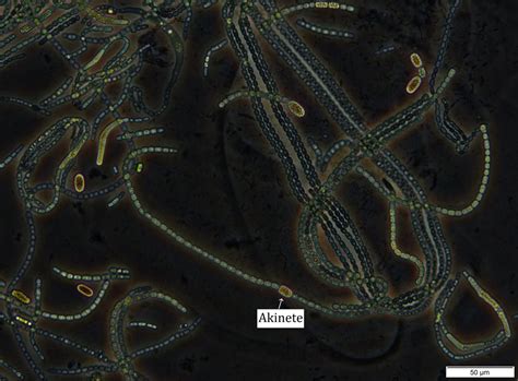 Nostoc - Cyanobacteria Guide