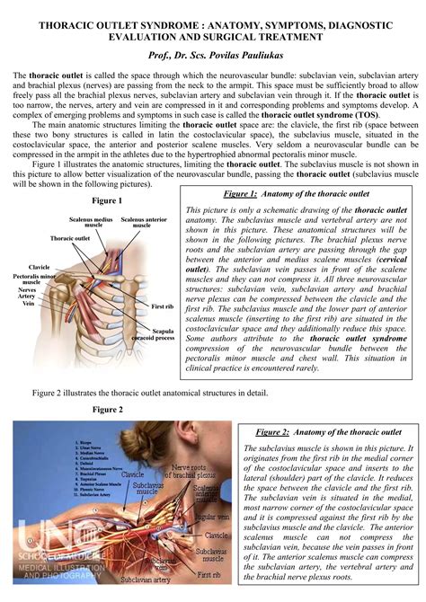 Thoracic Outlet Syndrome Anatomy Symptoms Diagnostic Evaluation And