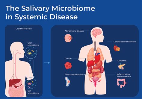 Saliva Microbiome Analysis As A Diagnostic Tool Norgen Biotek Corp