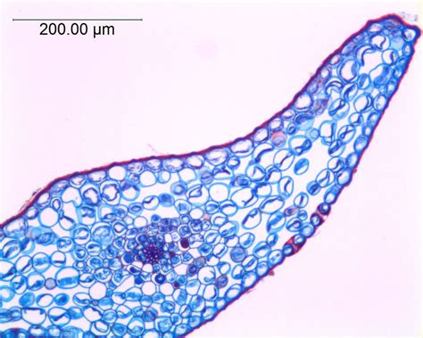 Lycopodium (Lycopodiaceae) image 41446 at PhytoImages.siu.edu