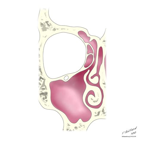 Radiopaedia - Drawing Ostiomeatal complex - no labels | AnatomyTOOL