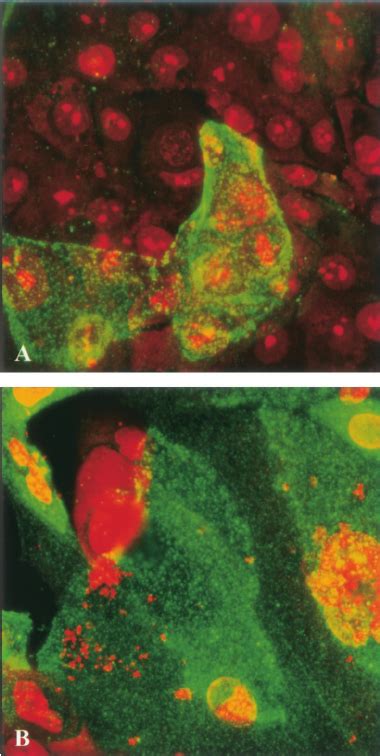 Immuno Fl Uorescence Confocal Microscopy Showed That Thuec Express